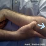 体态康复问答｜肘关节疼痛，网球肘怎么康复？