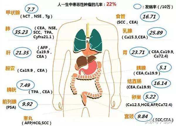 一查就是七八千还确诊不了，肺癌确诊要花多少钱，哪样检查最准确