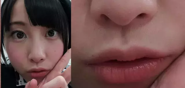 女生长小胡子真丑?学会十大小妙招,让你轻松摆脱唇毛困扰