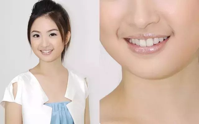 女生长小胡子真丑?学会十大小妙招,让你轻松摆脱唇毛困扰