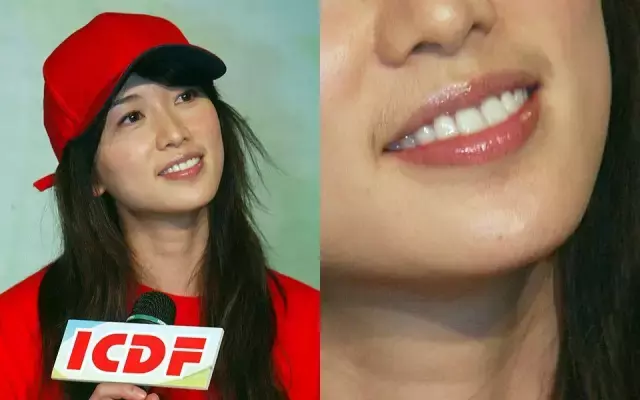 女生长小胡子真丑?学会十大小妙招,让你轻松摆脱唇毛困扰