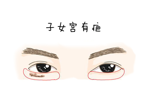 眼睛周围这几个部位有疤，竟会影响运势，要注意了