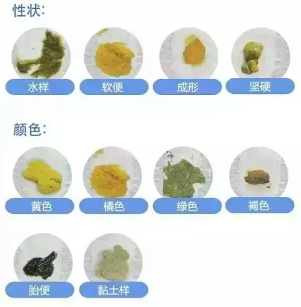 宝宝肠胃好不好，看看便便颜色就知道