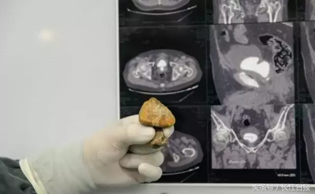 7月22日早安武汉︱湖北高招一本录取信息今日可查询；孩子们最爱的戏曲夏令营又能报名了