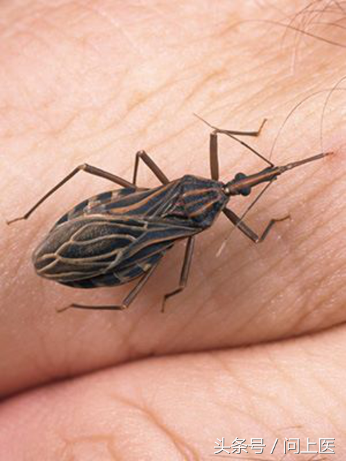 被螨虫咬的症状图片(图解12种常见蚊虫叮咬的皮肤痕迹) - 赤虎壹号
