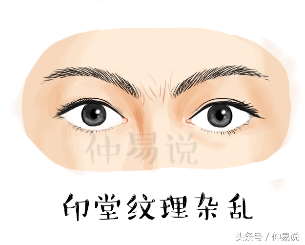 印堂凹陷有什么不好（4种不同的女子印堂）
