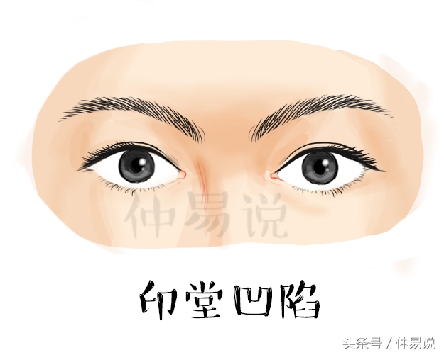 印堂凹陷有什么不好（4种不同的女子印堂）