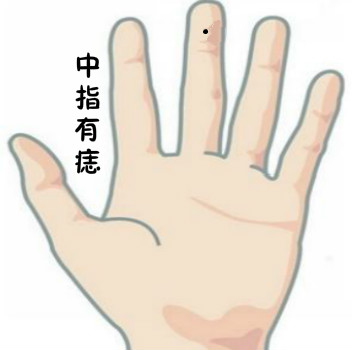 男人右手小指有痣好吗 痣相图解_达一风水网