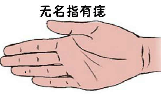 手指长痣的寓意,哪根手指长痣桃花多?