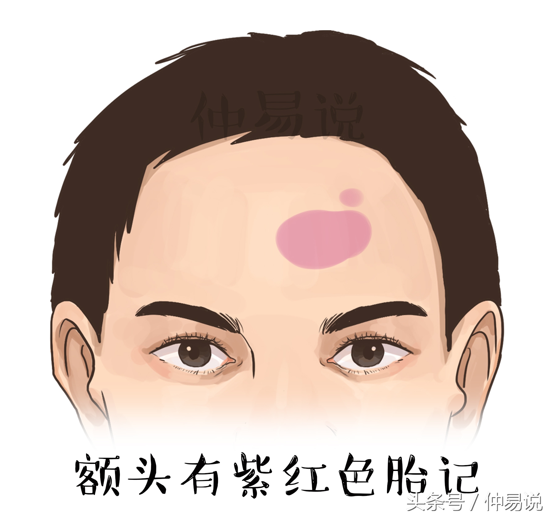 额头有痣,斑,胎记,看你一生的命运好不好