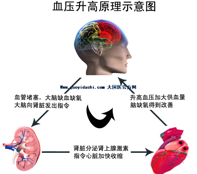 高血压患者注意！服用降压药的正确时间