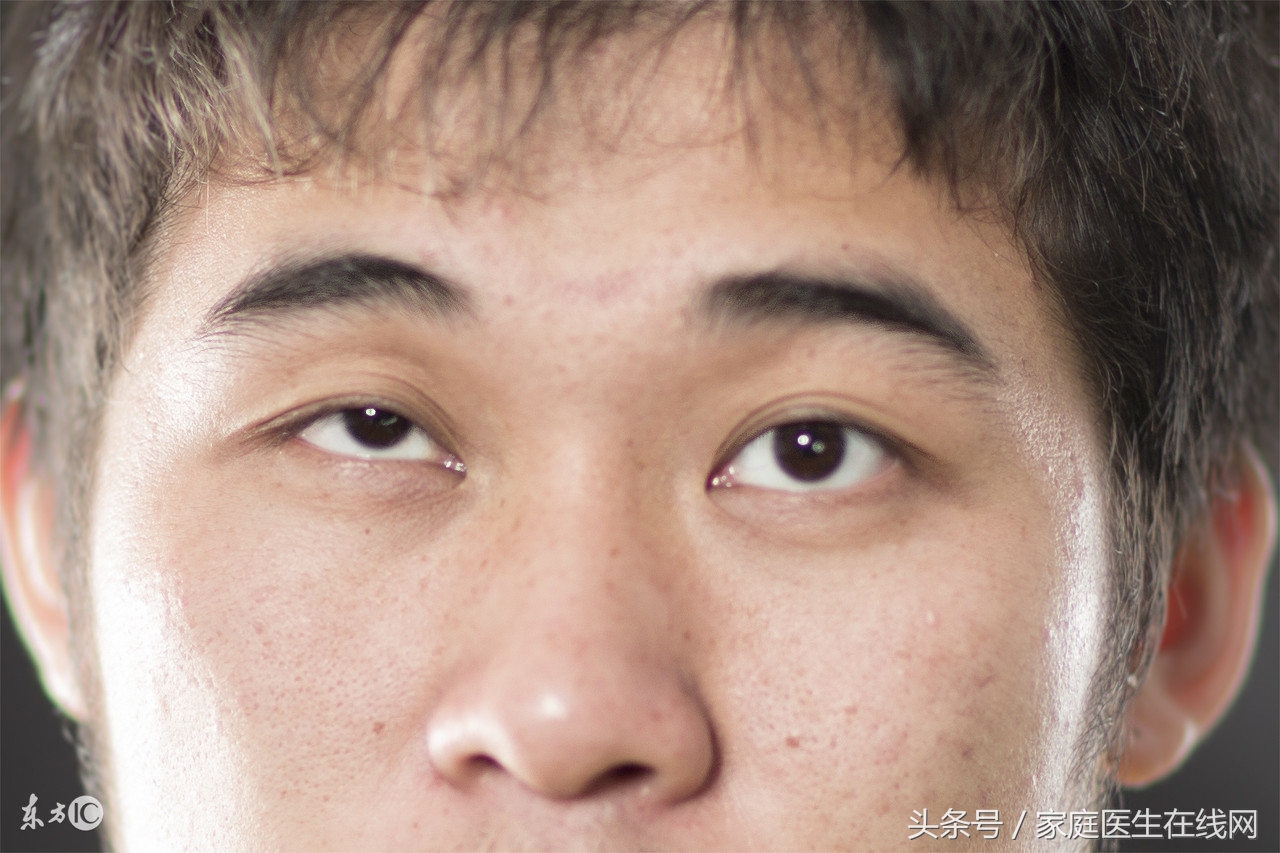 眼皮老是抽搐是什么原因，缓解眼皮跳的3个办法？