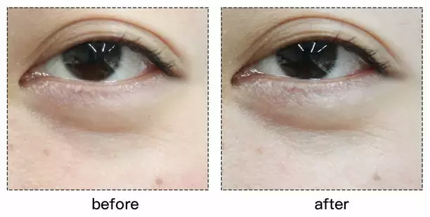 套路还是真有用？千元Refa和9.9元的滚轮瘦脸仪到底有差别吗？