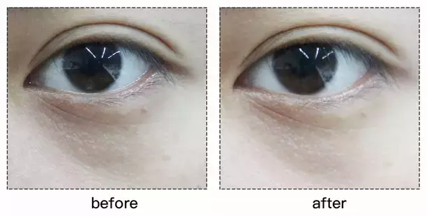 套路还是真有用？千元Refa和9.9元的滚轮瘦脸仪到底有差别吗？