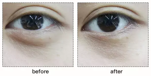 套路还是真有用？千元Refa和9.9元的滚轮瘦脸仪到底有差别吗？