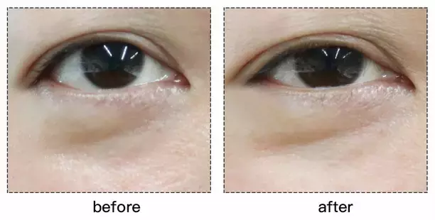 套路还是真有用？千元Refa和9.9元的滚轮瘦脸仪到底有差别吗？