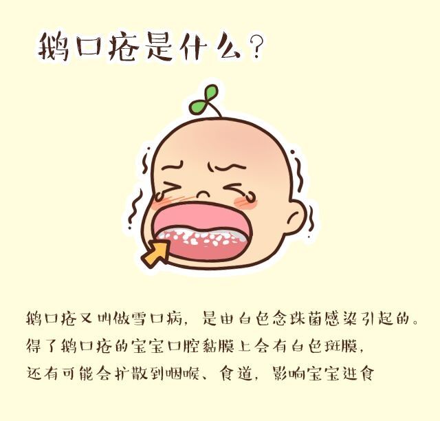 婴儿鹅口疮！最全的治疗方法！