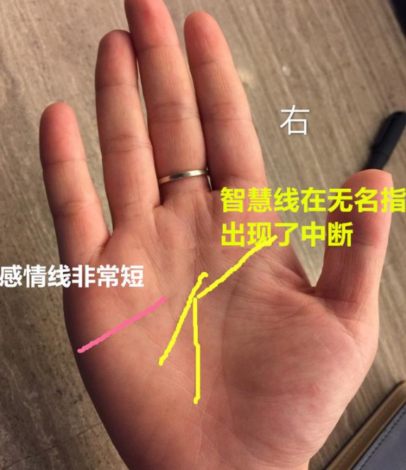 感情线非常短，婚姻生活多为不美满，婚姻上易有婚变！