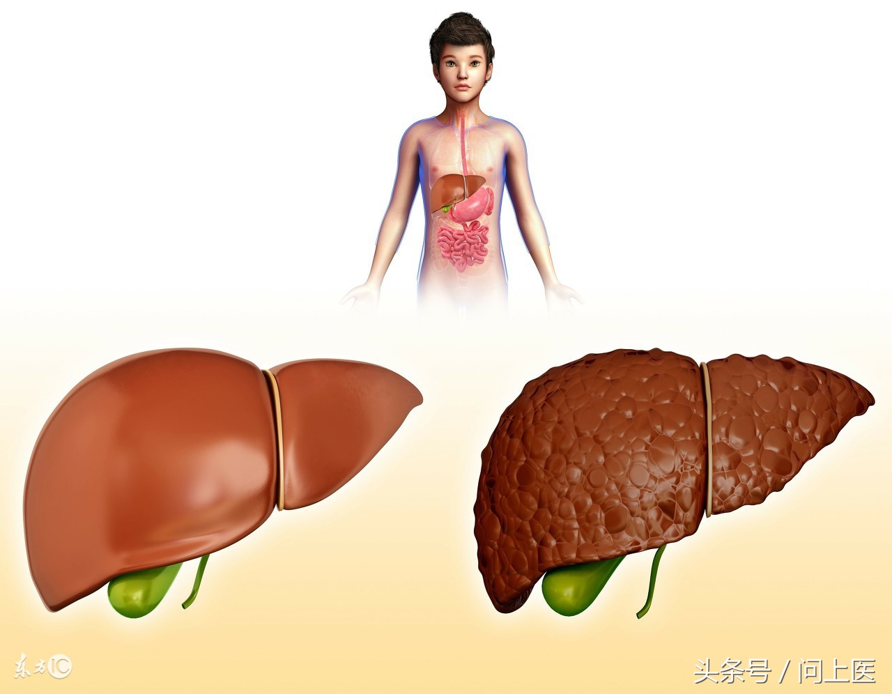 肝功能检查指标异常是什么原因？医生是如何诊断肝病的？