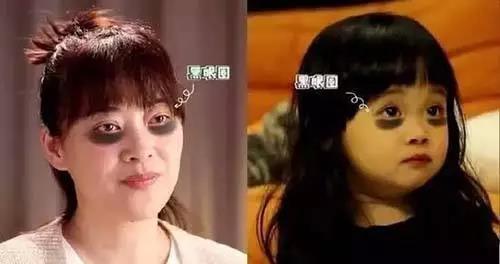 不用眼霜的女生注定比同龄人老十岁，说的是你吗？