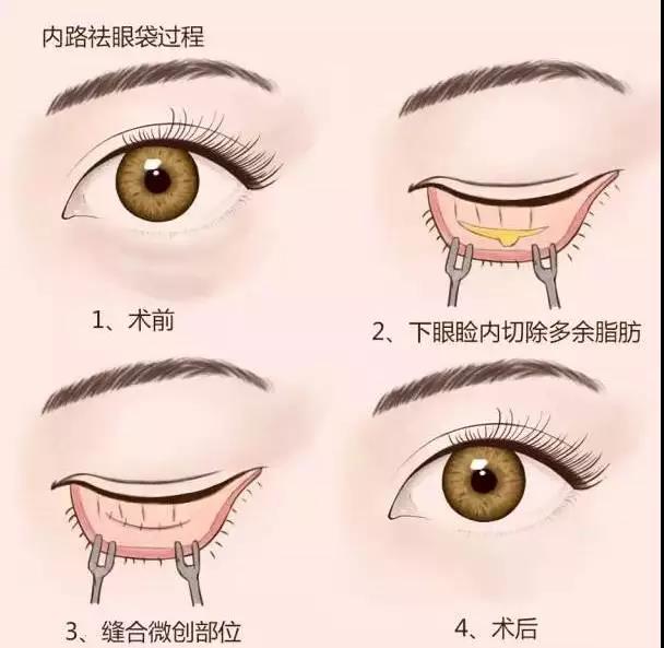 不用眼霜的女生注定比同龄人老十岁，说的是你吗？