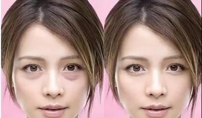 不用眼霜的女生注定比同龄人老十岁，说的是你吗？