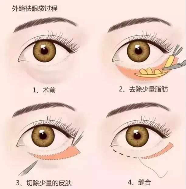 不用眼霜的女生注定比同龄人老十岁，说的是你吗？