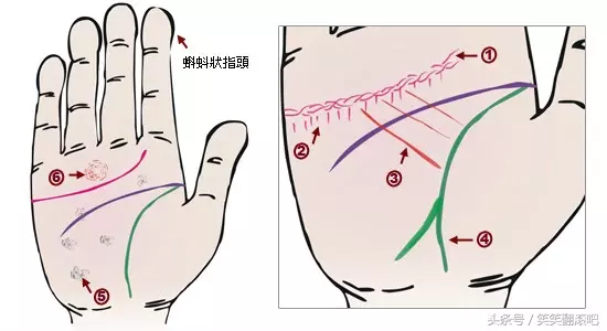 「健康」揭秘：从掌纹看你的身体是否健康