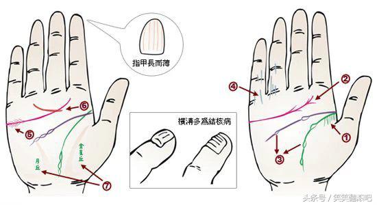 「健康」揭秘：从掌纹看你的身体是否健康