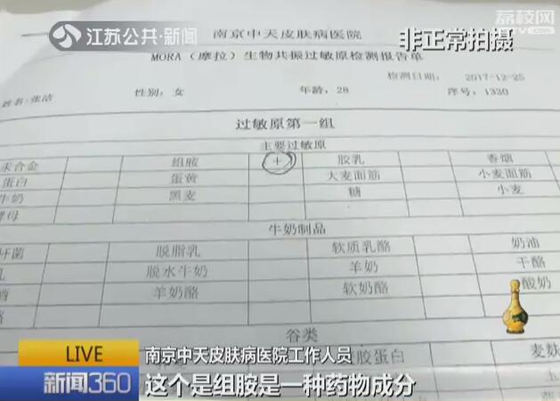 不抽血不皮试 仪器就能检出过敏原？