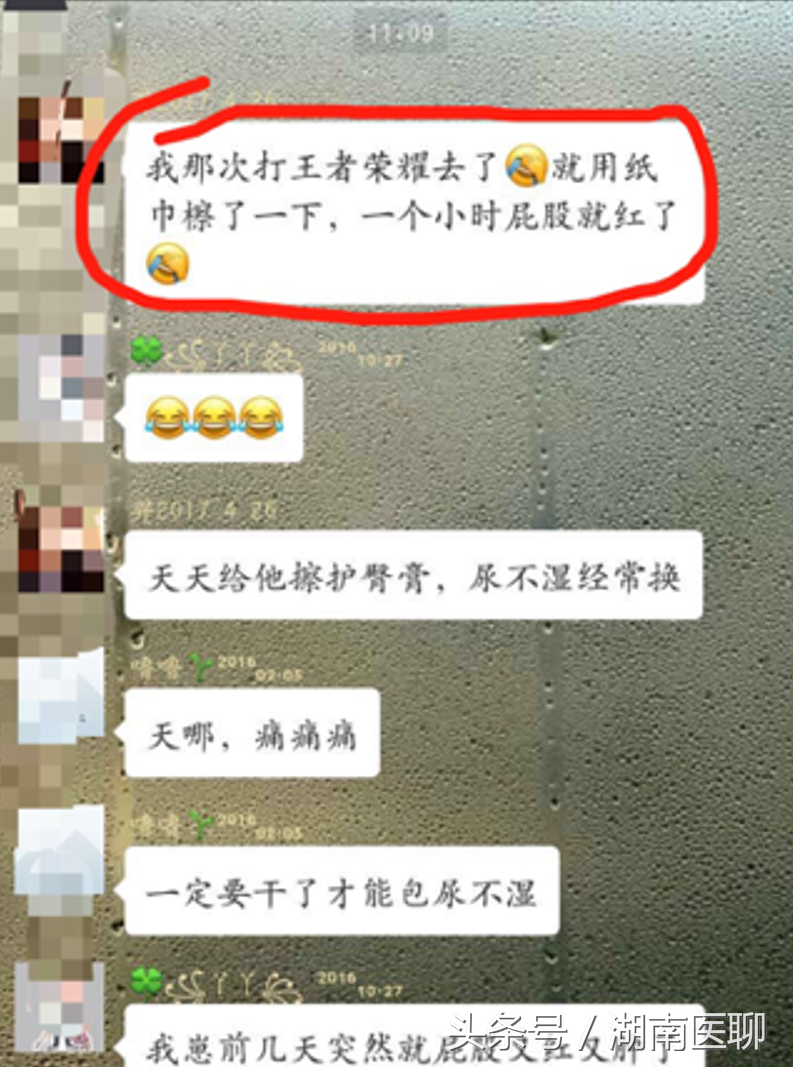 婴儿屁眼红是怎么回事（如何预防宝宝红屁股）