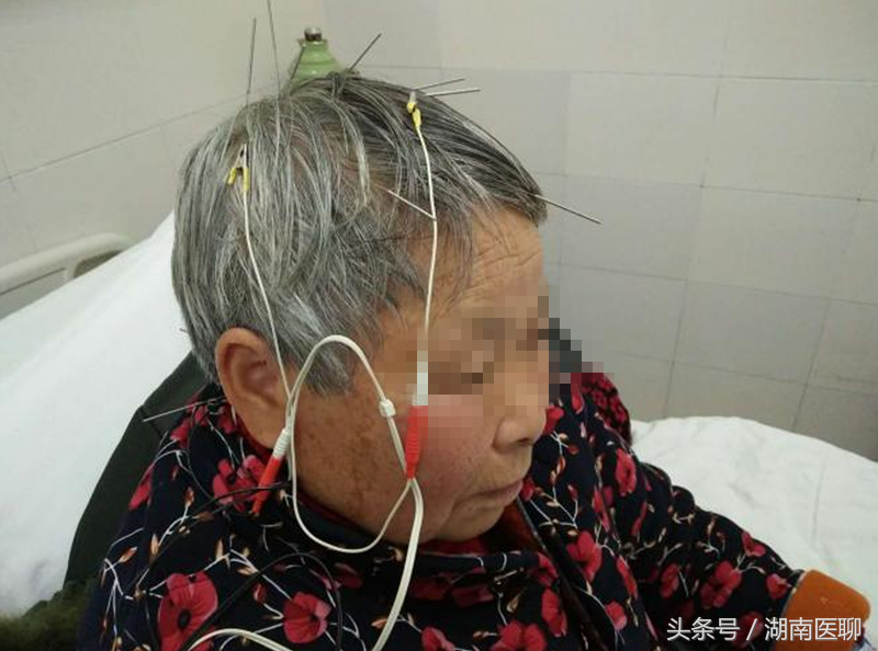 腿脚常抽筋苦不堪言？目前这种疗法对治腿抽筋超有效！
