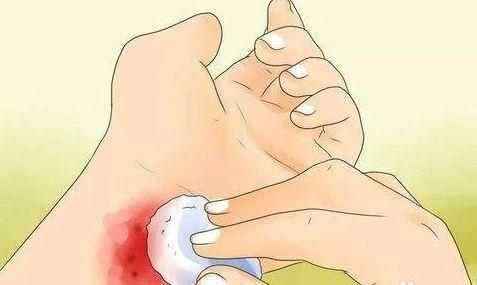 孩子擦破皮、被划伤戳伤，你知道正确的处理方法吗？