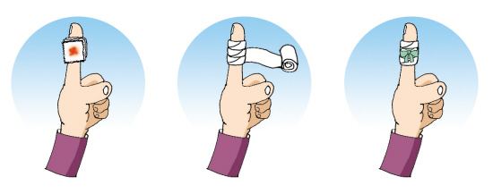 孩子擦破皮、被划伤戳伤，你知道正确的处理方法吗？