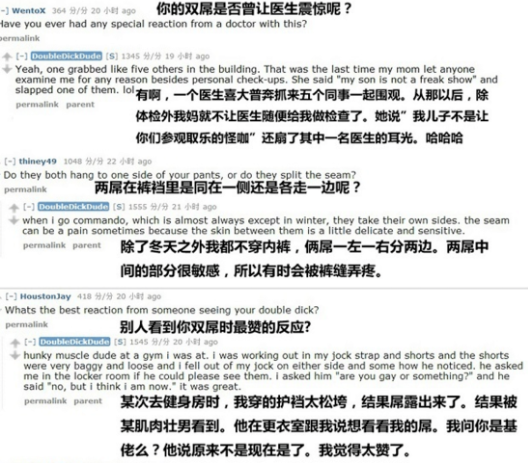 世界上真的存在双屌男，有图有真相