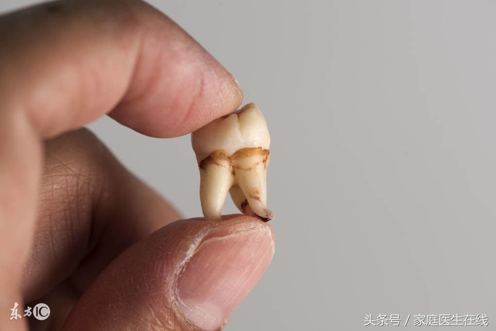 智齿是第三大臼齿,智齿不拔对于人的牙齿是有很大的危害的,一不小心就