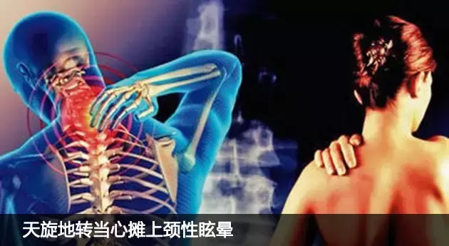 颈性眩晕的成因及发病机制解析