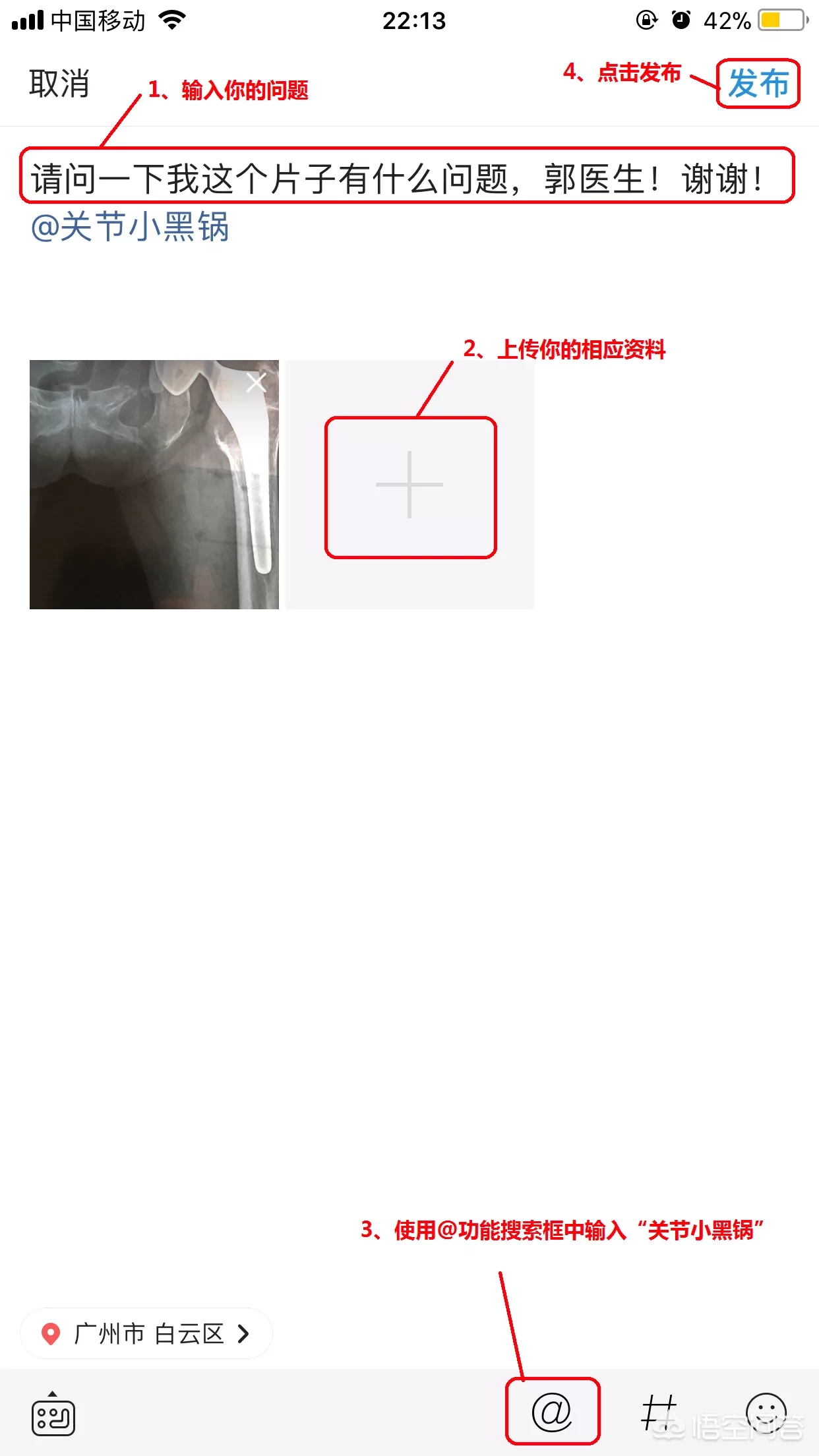 免费咨询医学问题的方法
