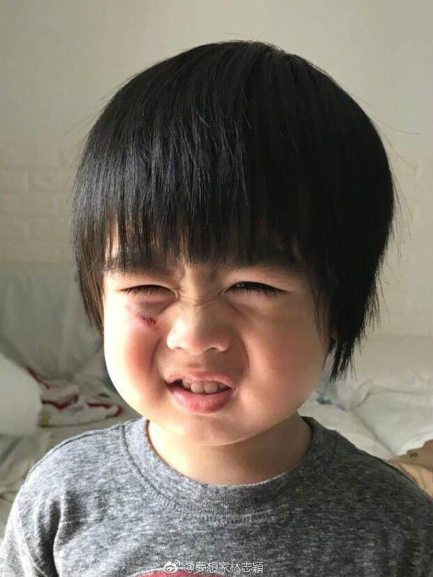 林志颖儿子脸跌伤我们第一时间要做什么