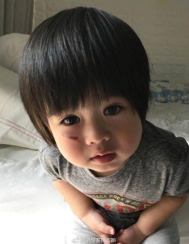 林志颖儿子脸跌伤我们第一时间要做什么