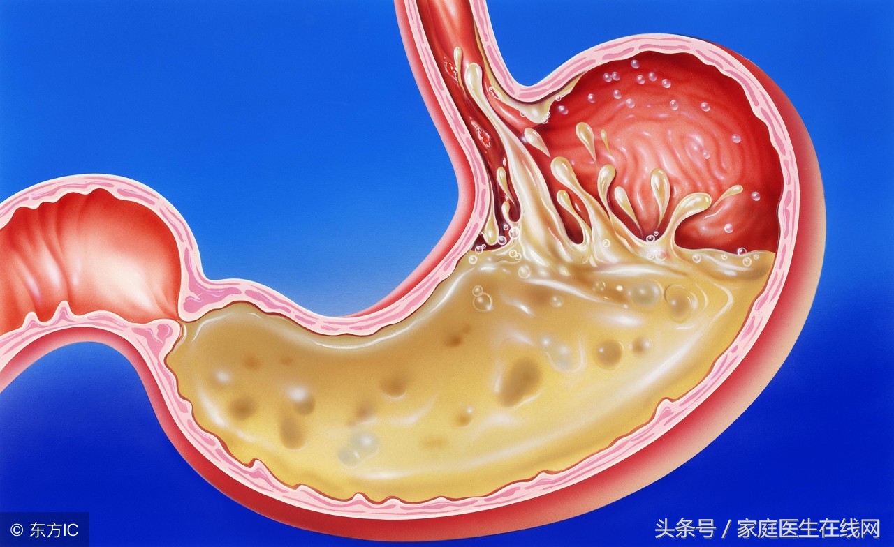 经常打嗝胃胀气，提醒你该做这3件事了，不要不以为意