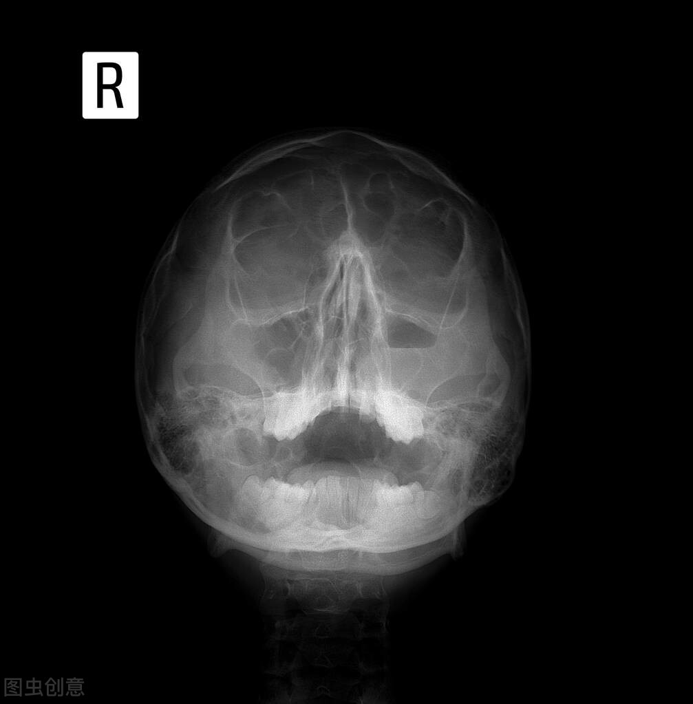 鼻窦炎会传染吗？鼻窦炎的症状缓解方法/治疗方法