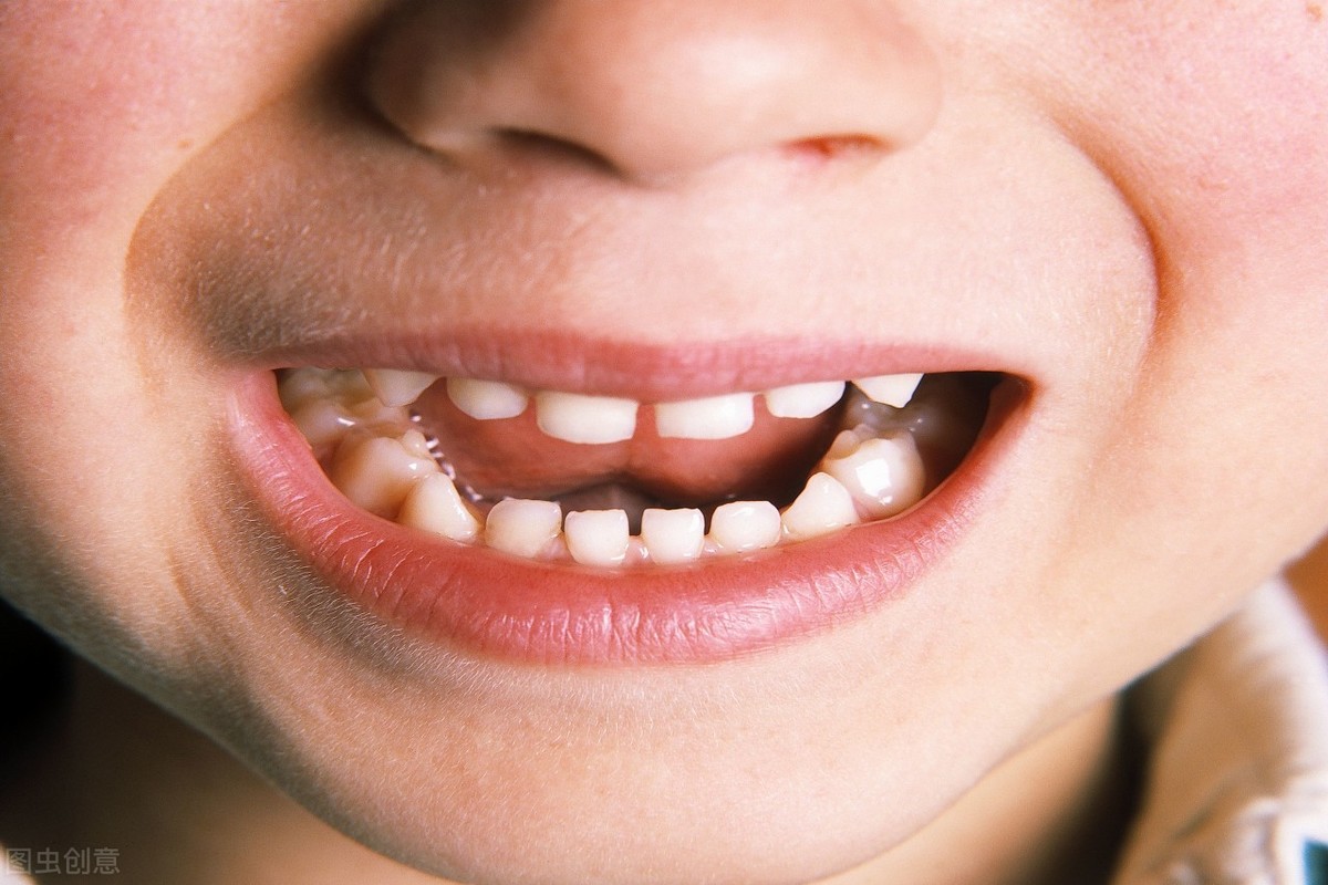 宝宝的牙齿为什么越长越稀?医生:丑牙缝预示高颜值,爸妈护理好