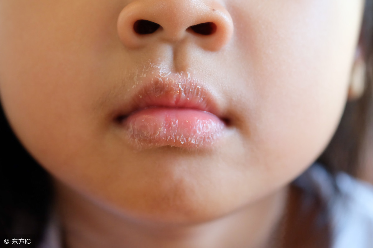 一个5岁男孩咬嘴唇的特写。照片摄影图片_ID:349360094-Veer图库