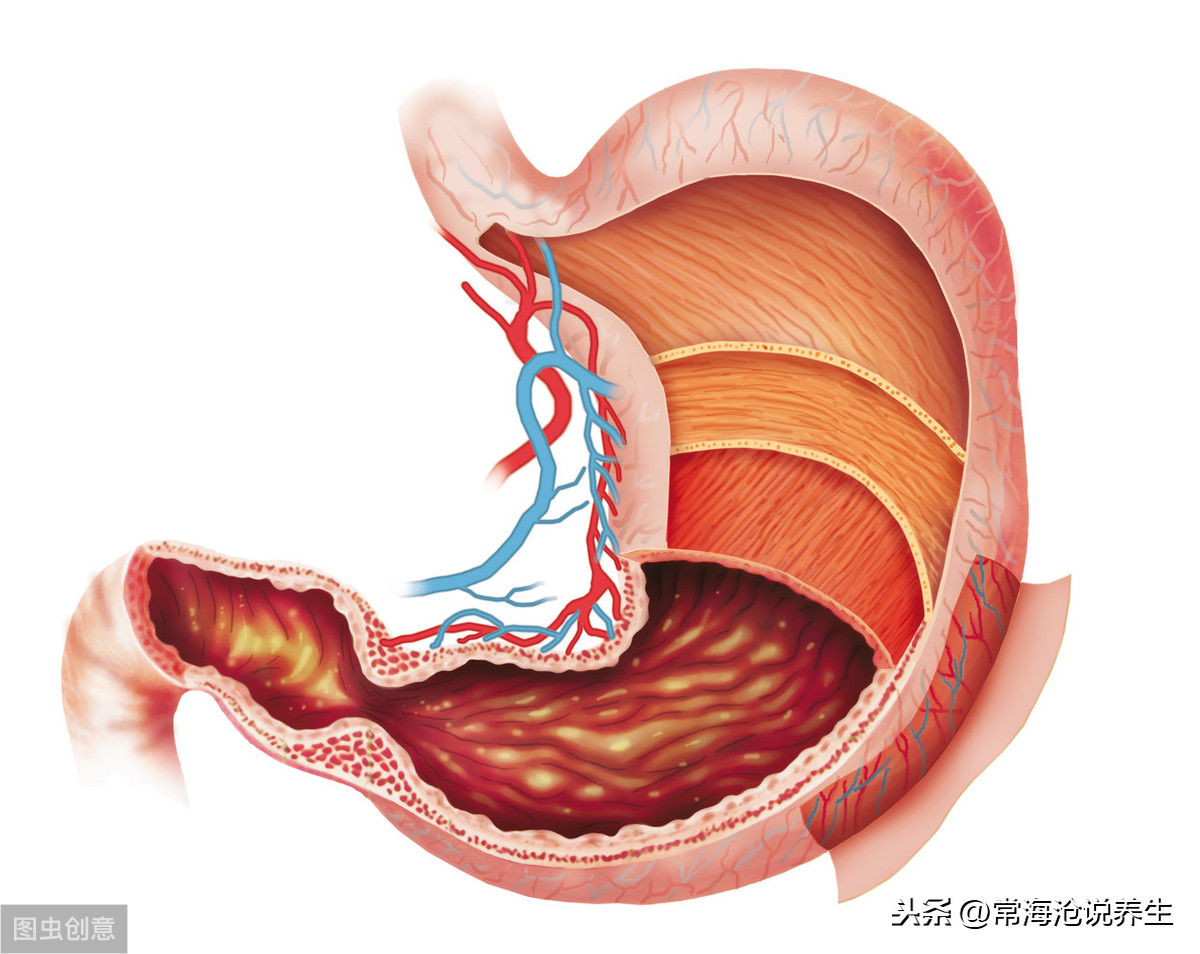 吃完饭胃胀、爱打嗝？肠胃可能感染了这种细菌，做好4点调理肠胃