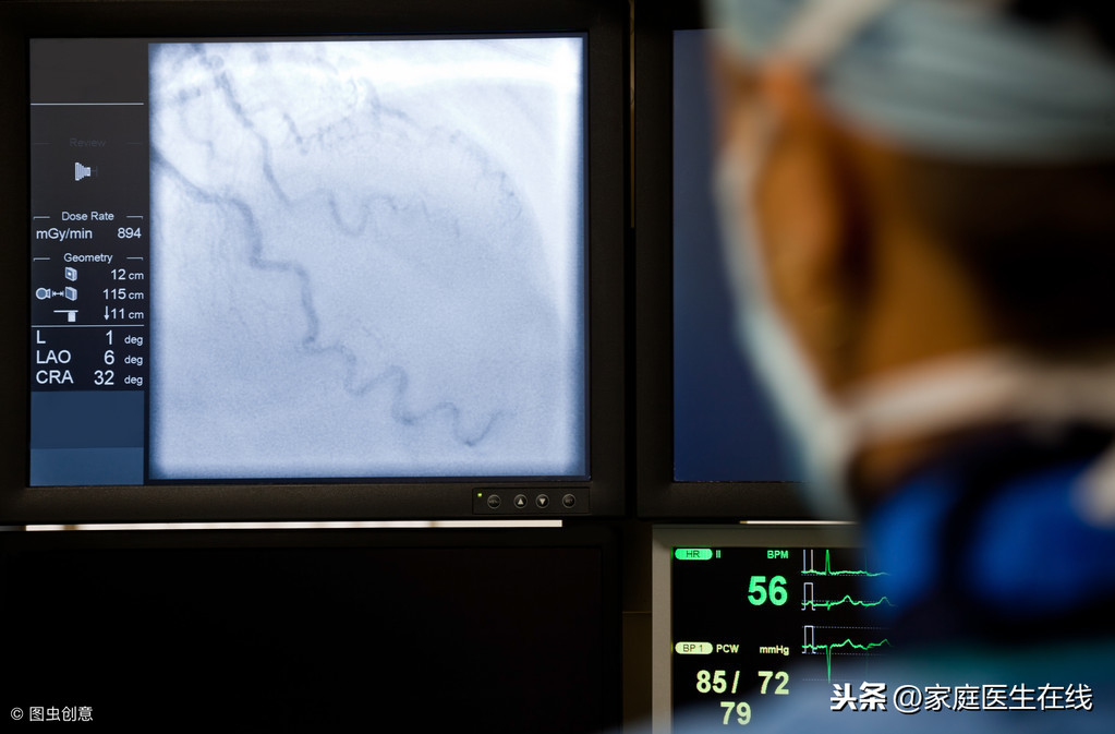 冠脉CT和冠脉造影有什么区别？这篇文章给你讲得很清楚