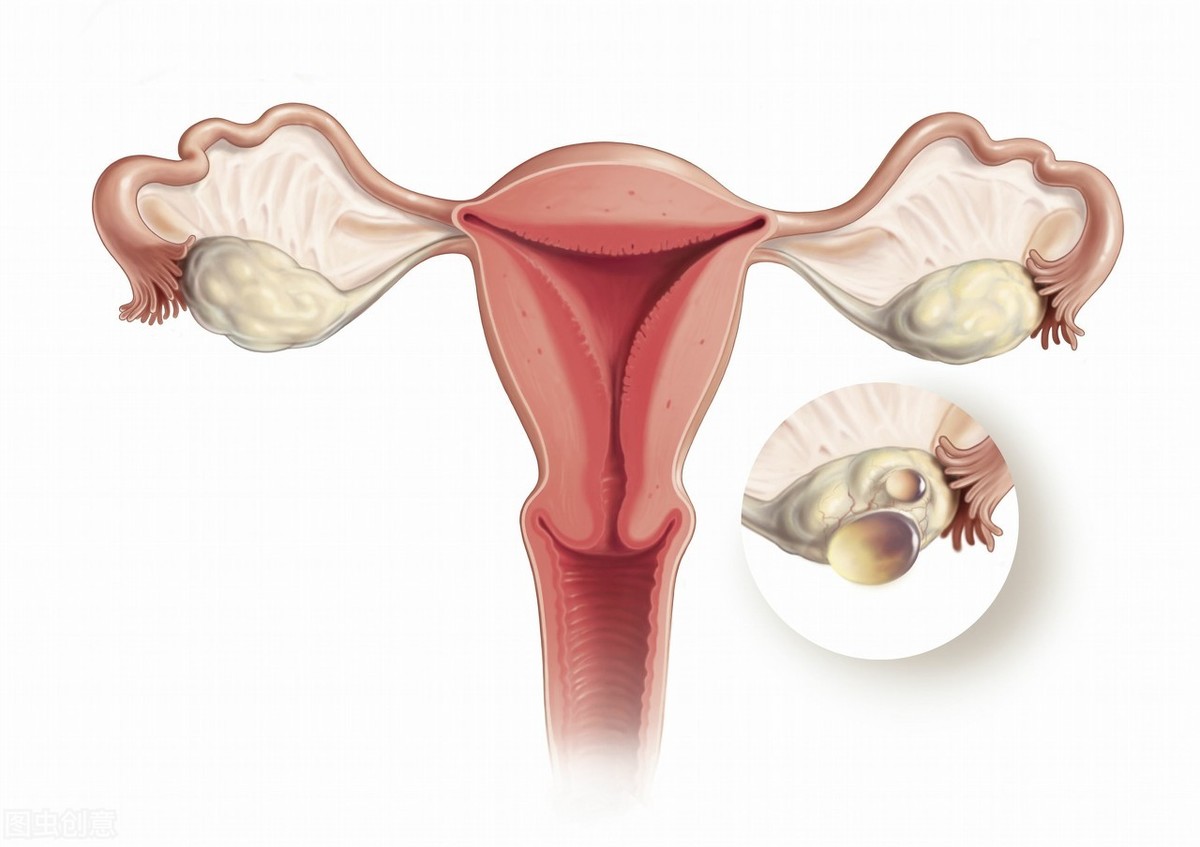 中医能看好卵巢早衰吗？恢复卵巢功能的中成药，建议收藏
