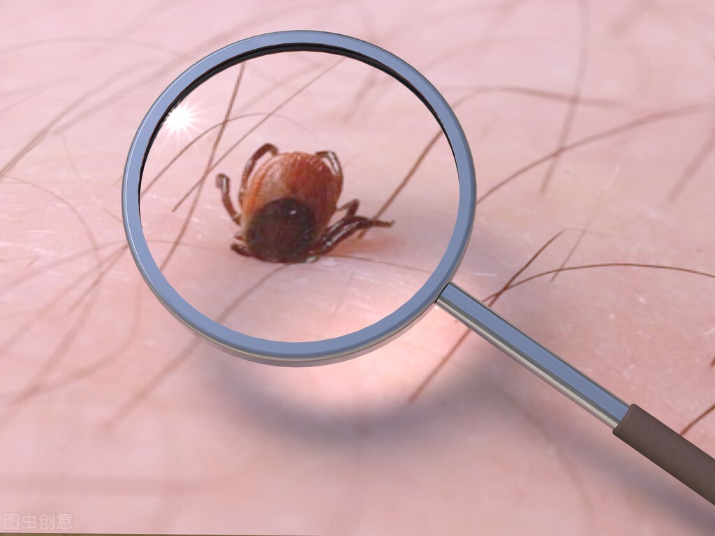 被螨虫咬的症状图片详解，螨虫性皮炎是什么？