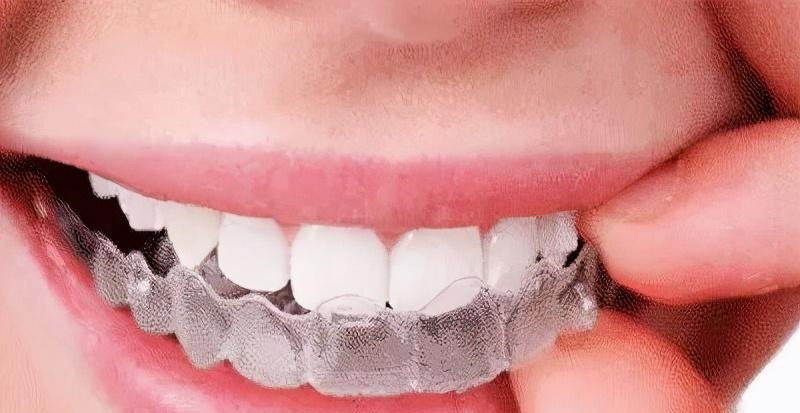 牙齿矫正结束后,保持器究竟要戴多久?