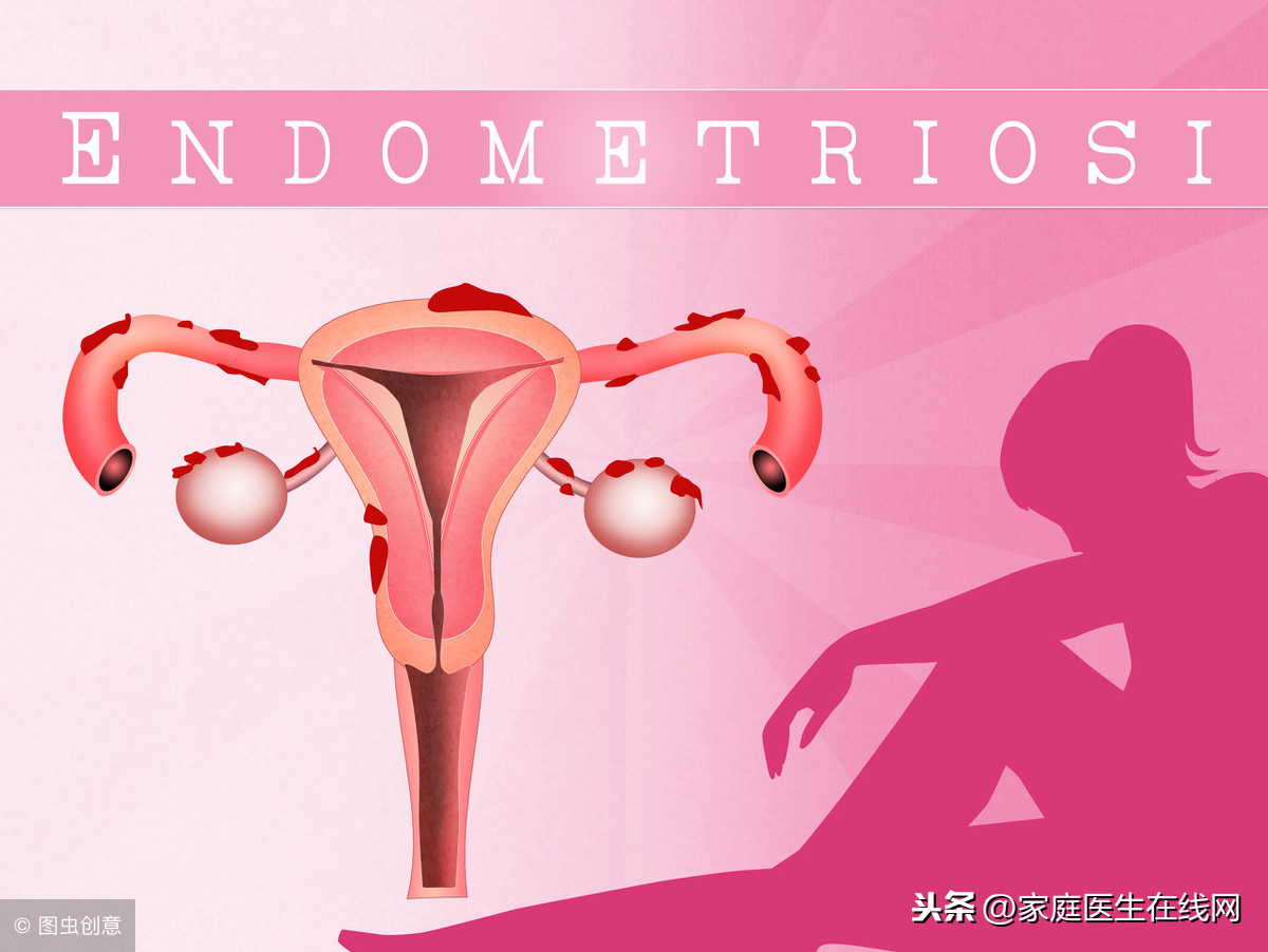 冻胚移植前子宫内膜刮宫流程，冻胚移植前子宫内膜刮宫后要注意什么